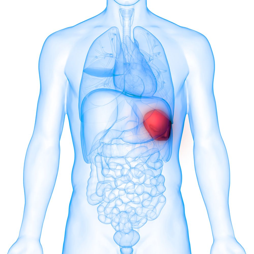 Spleen Removal