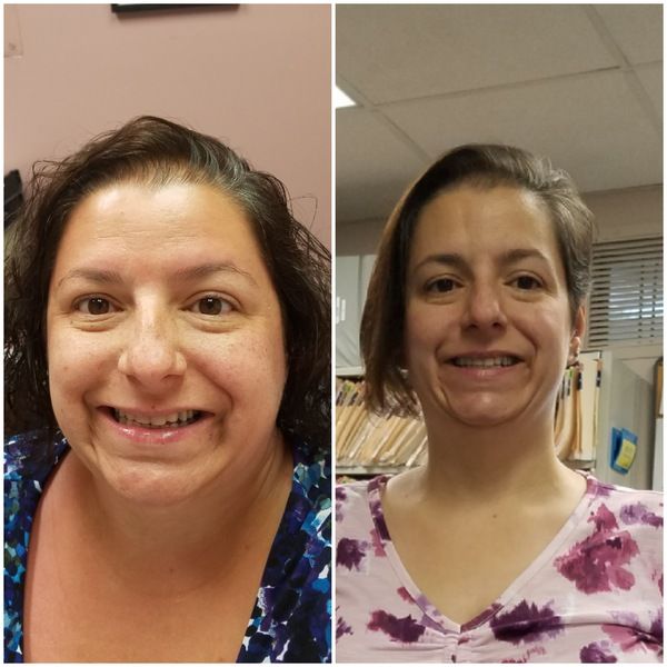 Face Before and After Photo