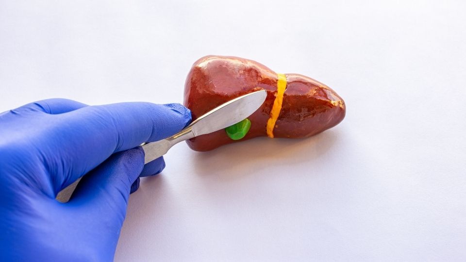 What Is the Recovery Time for Gallbladder Surgery?