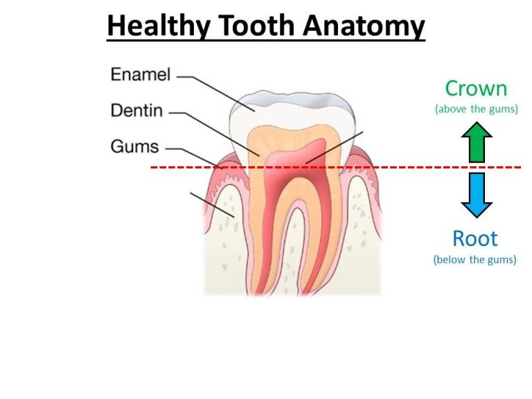 root canal therapy