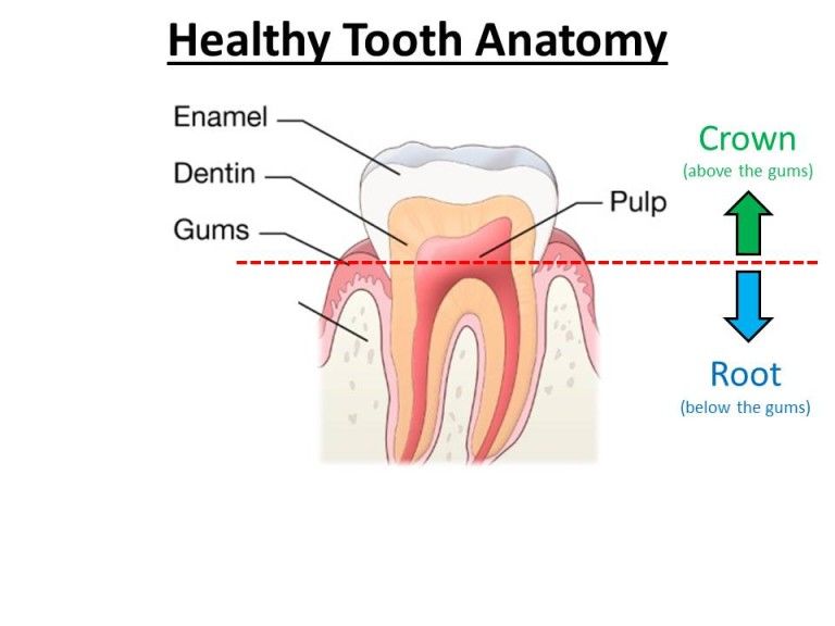 infection in root canal