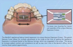 full arch orthodontics