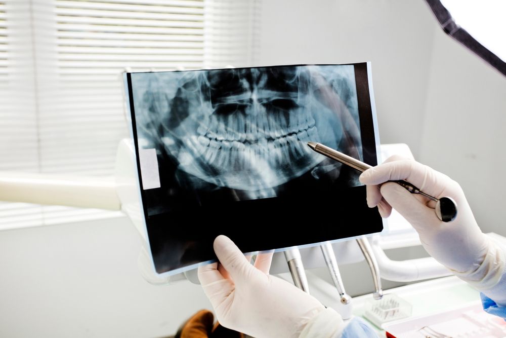 oral cancer screening