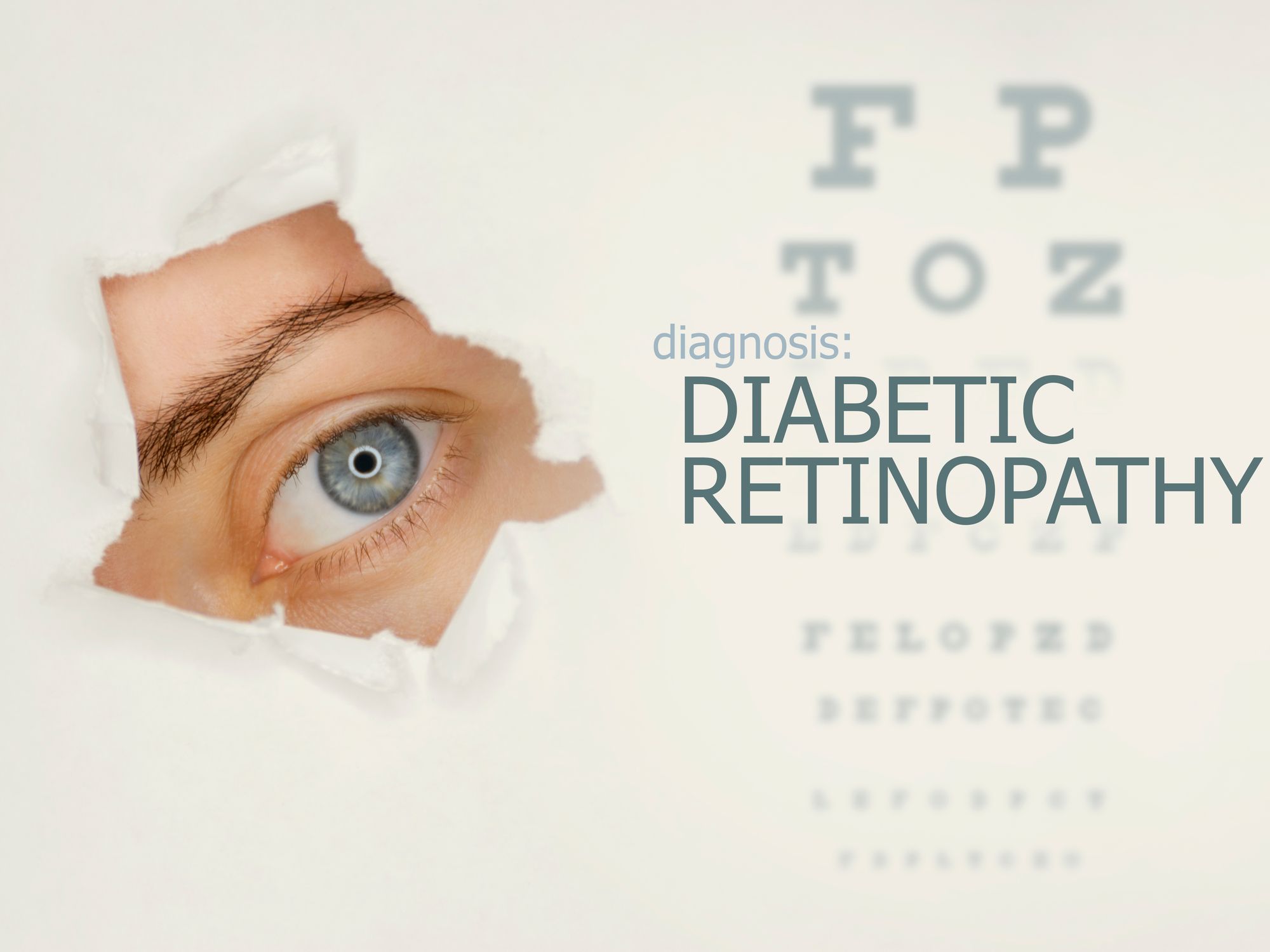 How Diabetes Impacts Eyesight