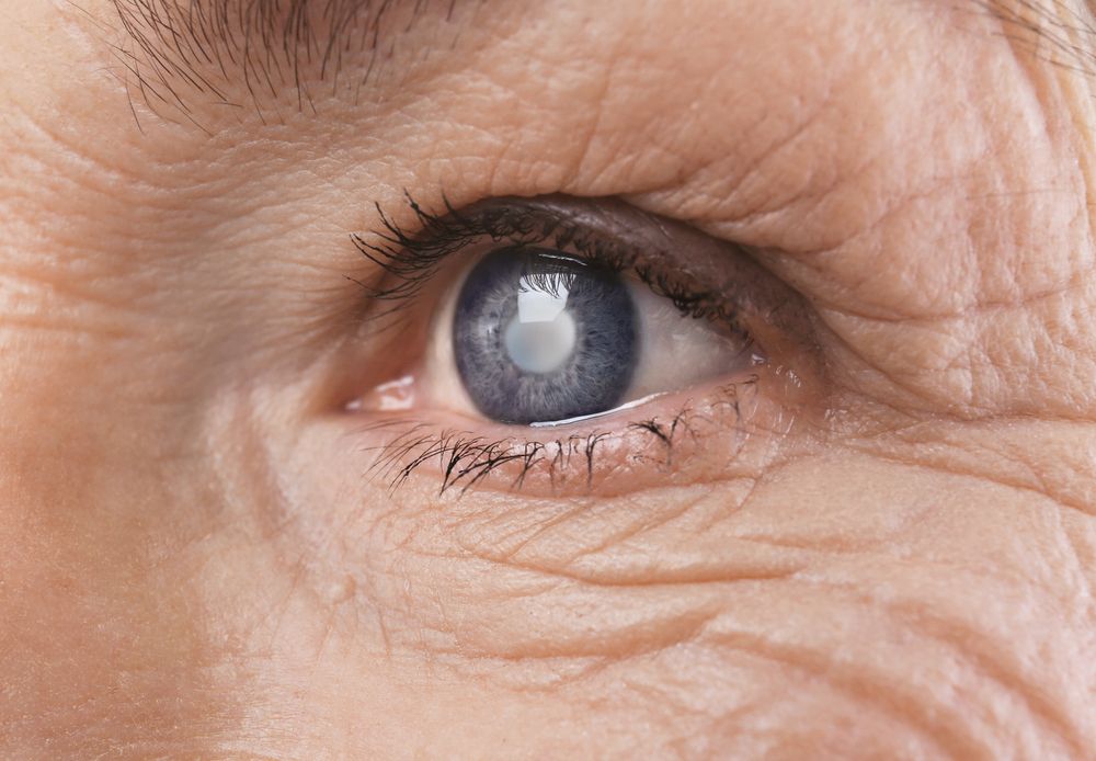 woman with Glaucoma
