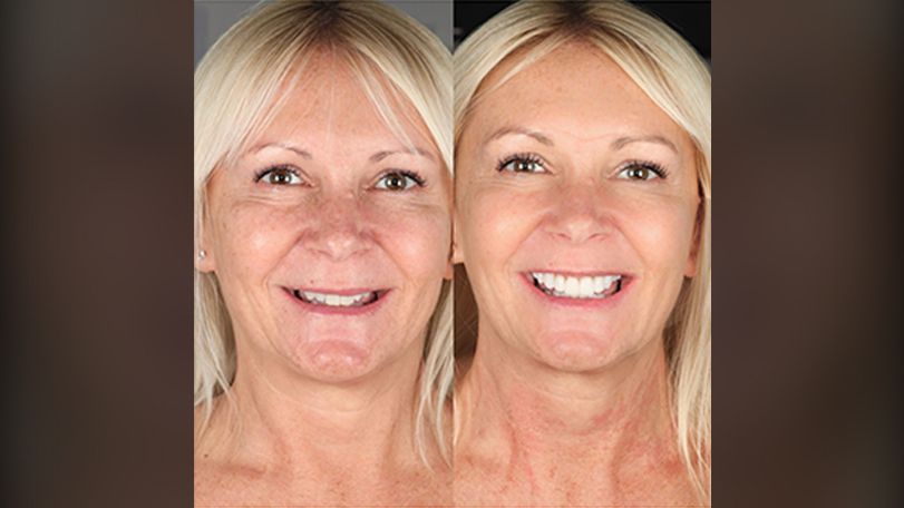 Psychology of a youthful smile
