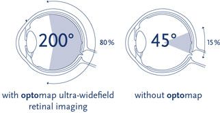 Contact lens