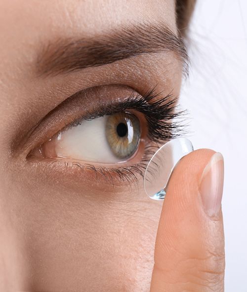 Contact lens