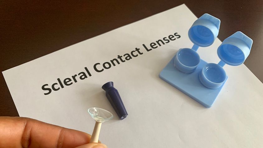 Scleral Lens Image