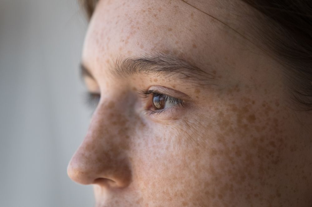 What Are My Best Options For Dry Eye Treatment?