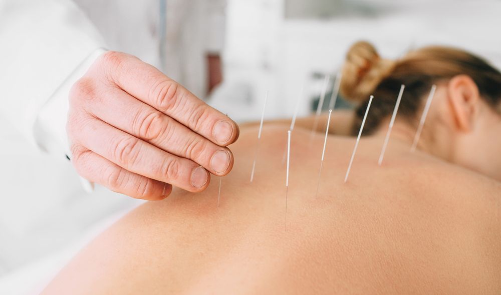 How Acupuncture Eases Back Pain and Sciatica