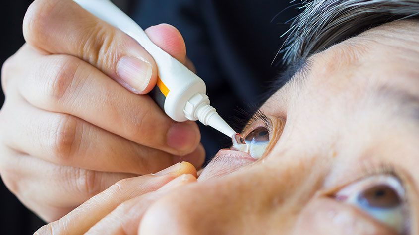 Woman having dry eyes