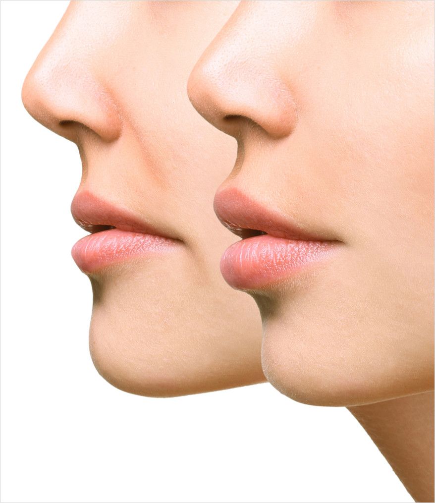 woman's lips