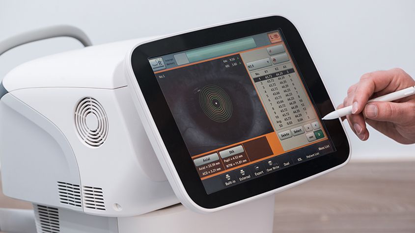 optical coherence tomography