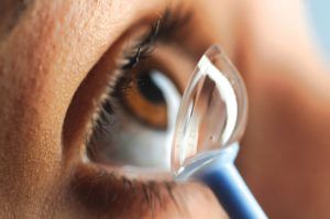 Keratoconus: Causes, Symptoms, Diagnosis, and Treatment