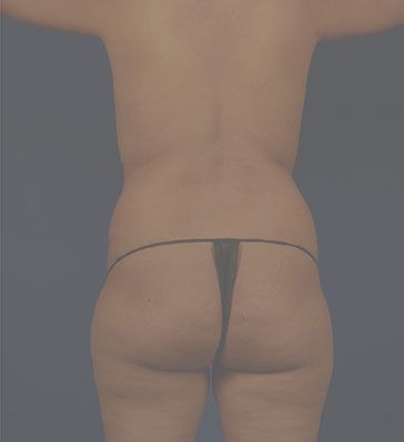 Back Facing Photo Sample