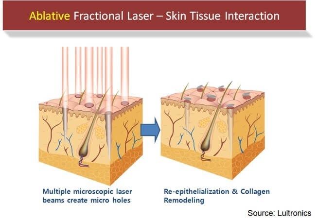 skin equipment