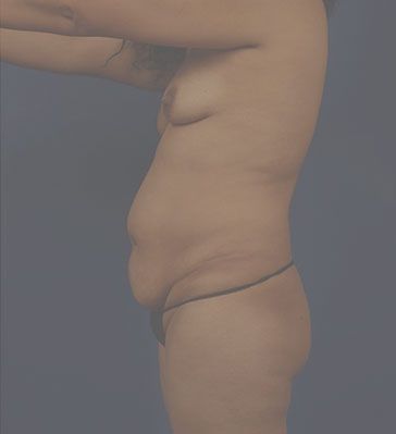 Left Profile Photo Sample