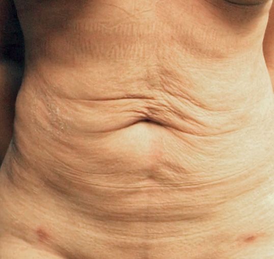 Before J-Plasma