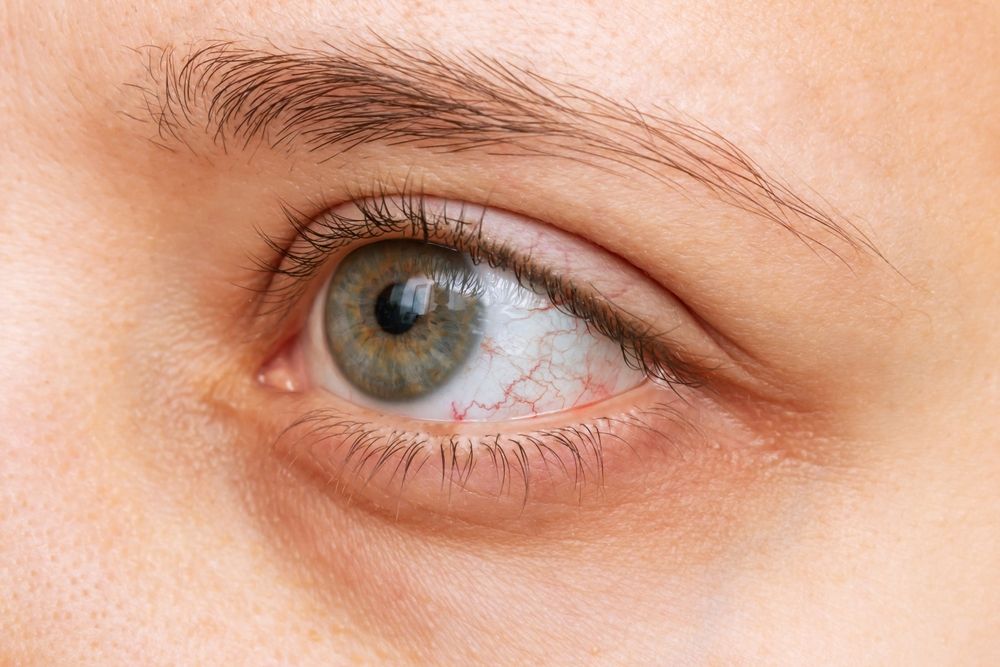 Dry Eye Disease