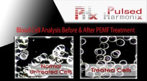 blood cell analysis