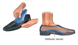 graphic of orthotics