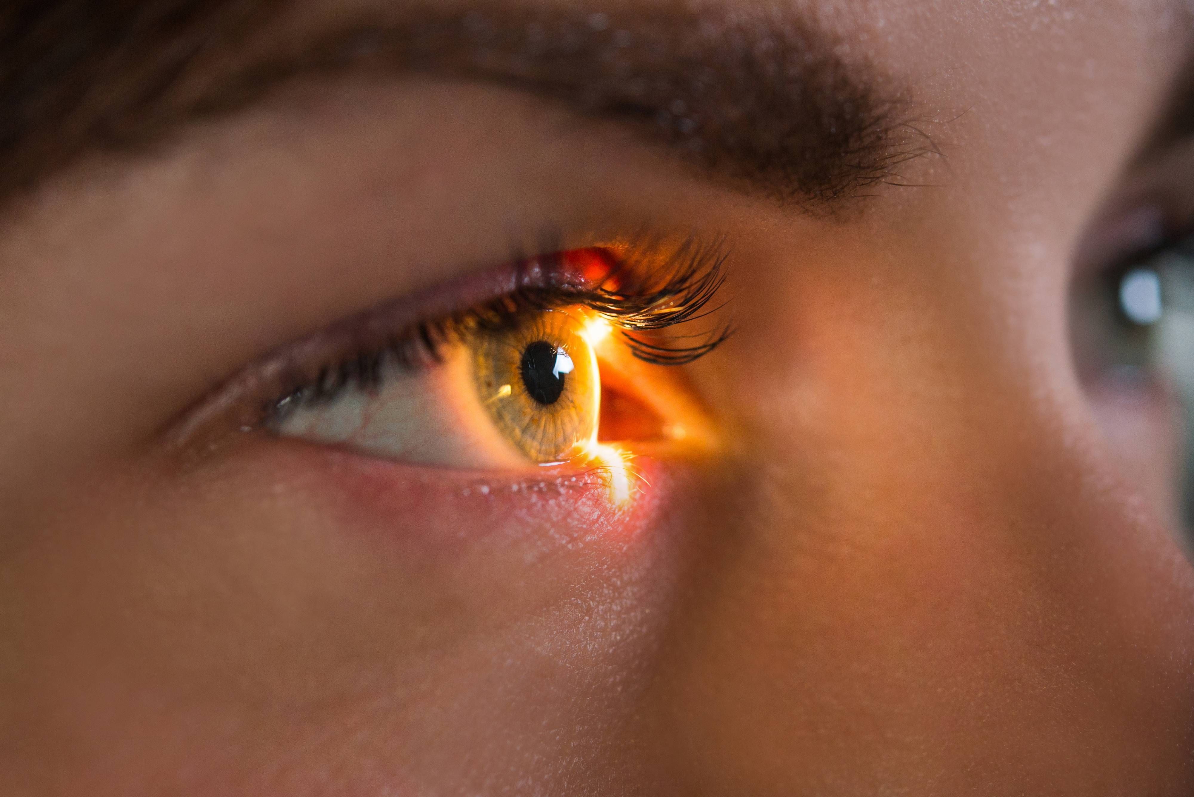 Benefits of Low-Level Light Therapy for Treating Dry Eye