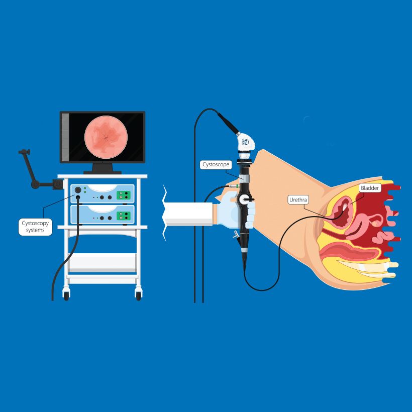 Cystoscopy and Ureteroscopy