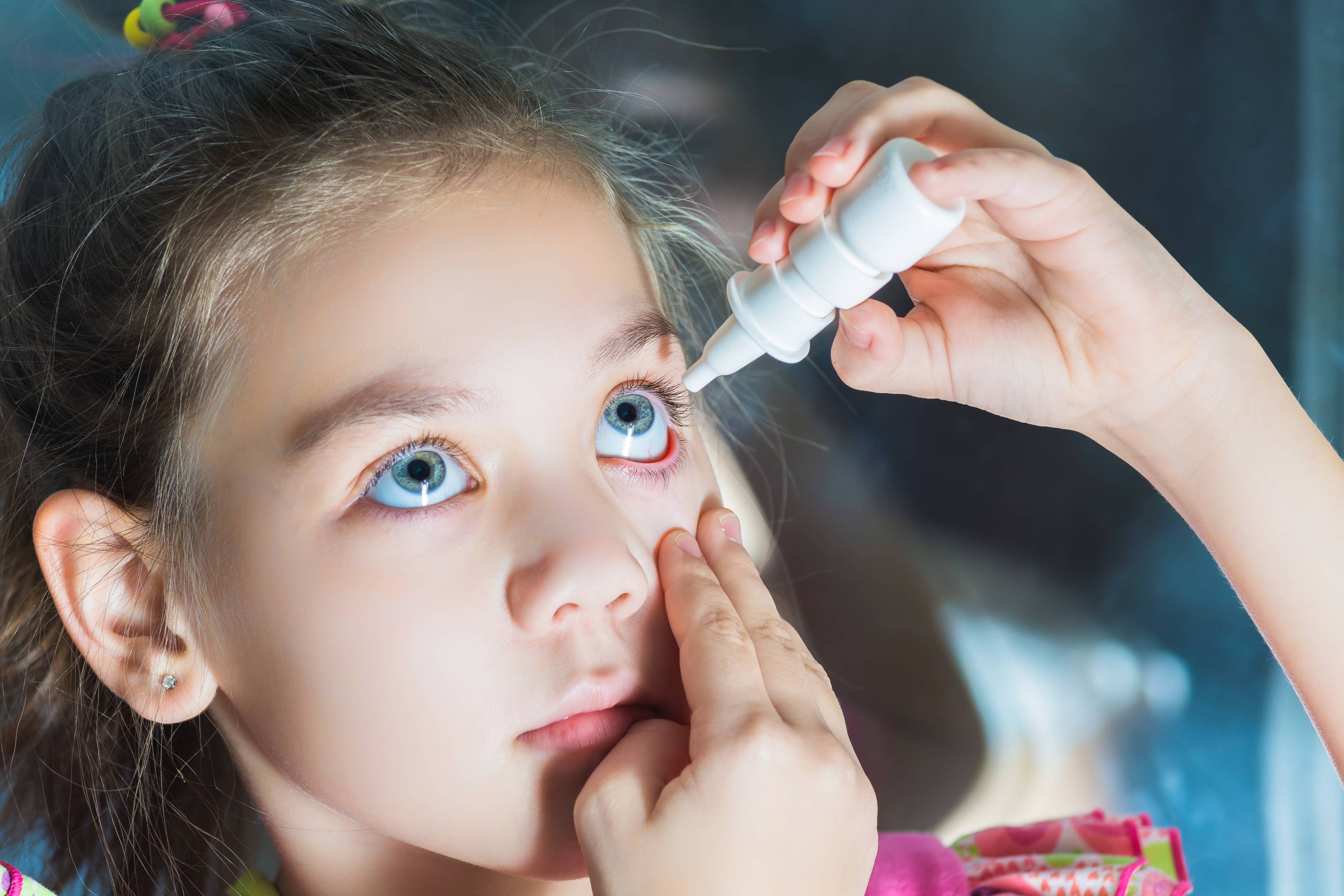 Atropine Eye Drops for Myopia in Children
