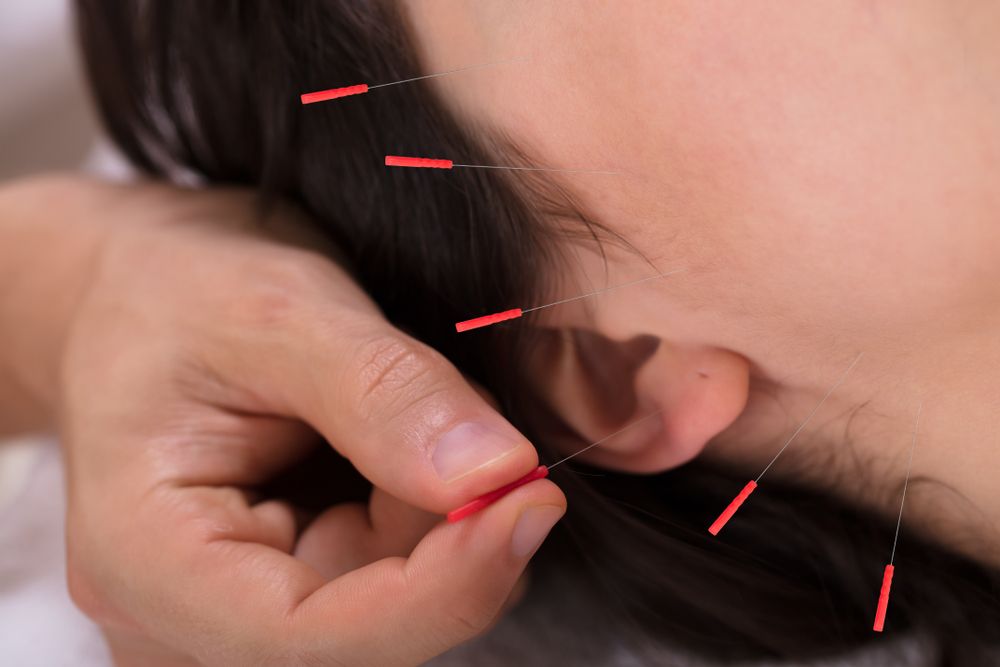 Unlocking Acupuncture's Healing Power: Injuries You Didn't Know It Could Treat