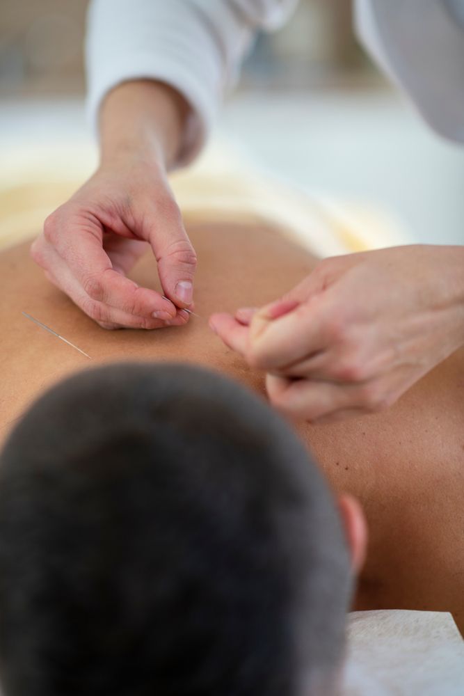 How to Maintain Acupuncture Results