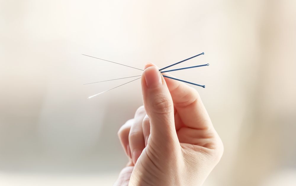 How Acupuncture Can Help You with Symptoms