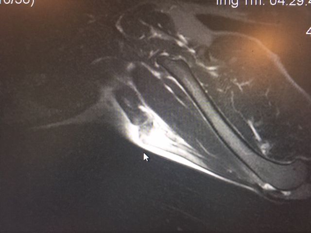 MRI image