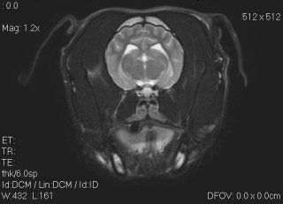 axial mri