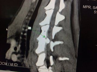 Crackhead’s Radiograph