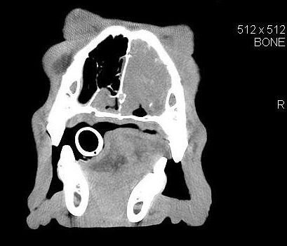 computed tomography