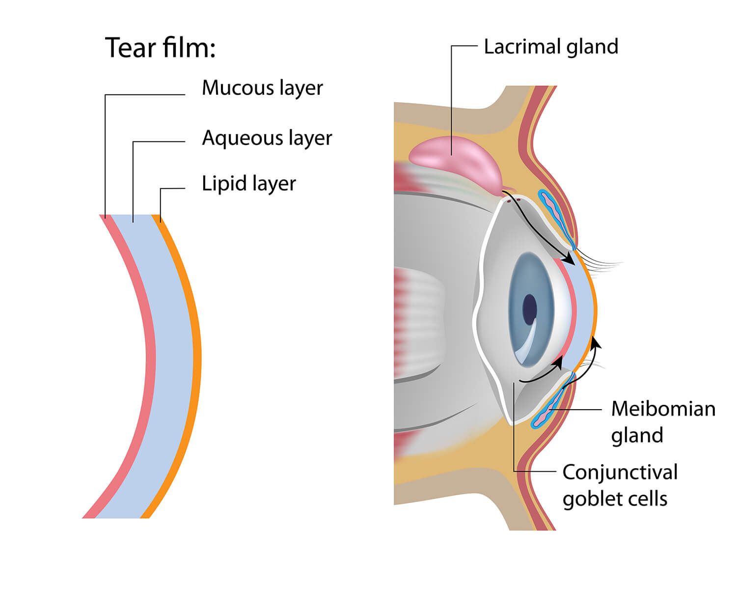 dry eye syndrome