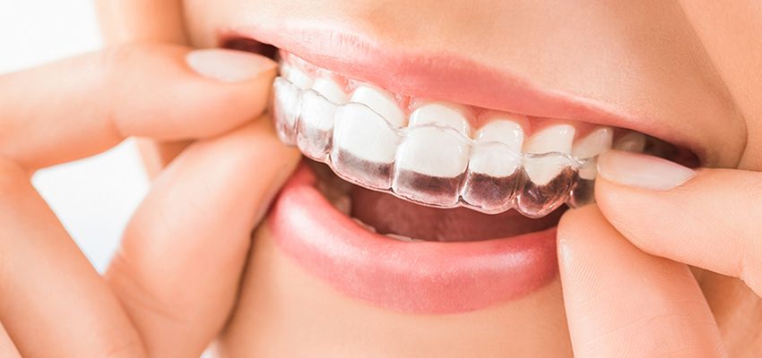 Dentist in Los Angeles CA & El Segundo CA