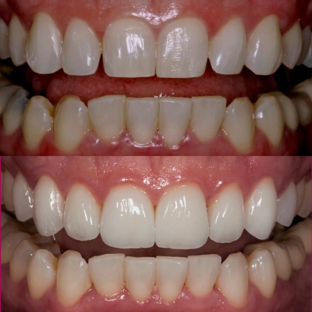 cosmetic dentistry