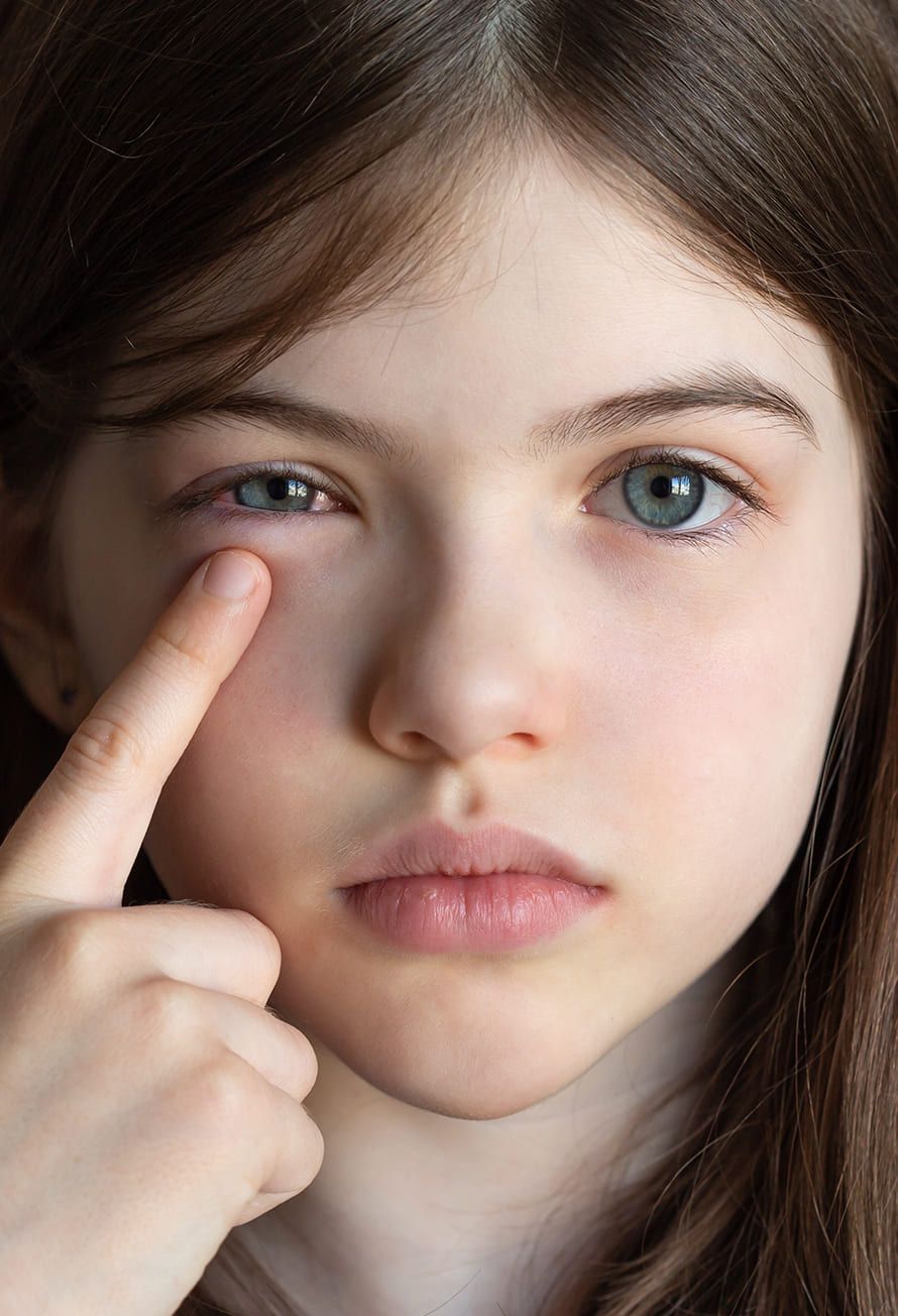 Eye Infection