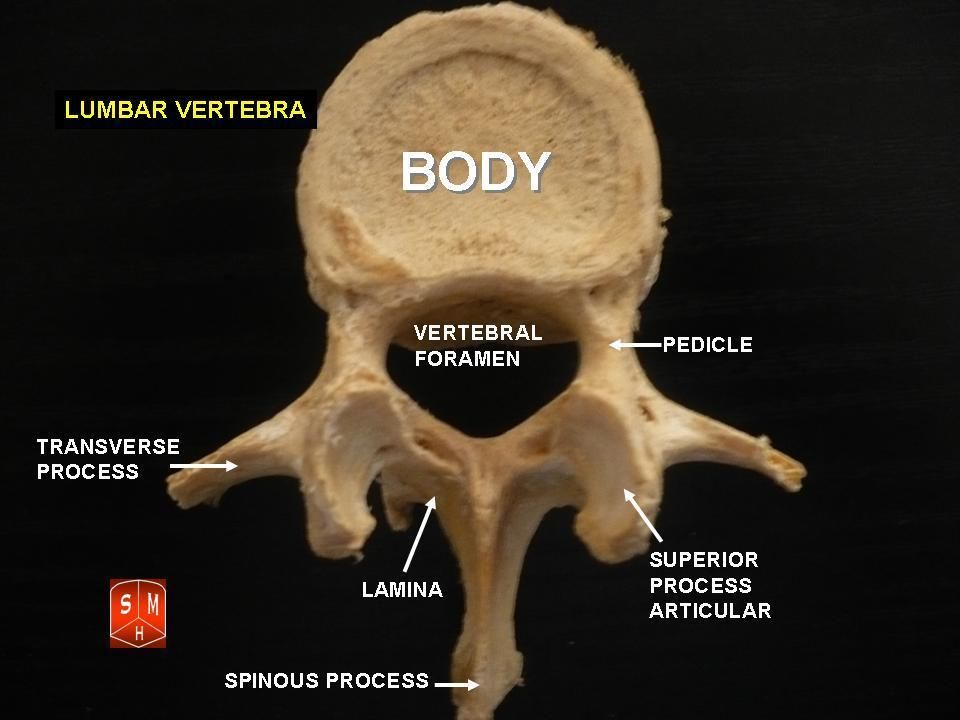 Spinal Stenosis