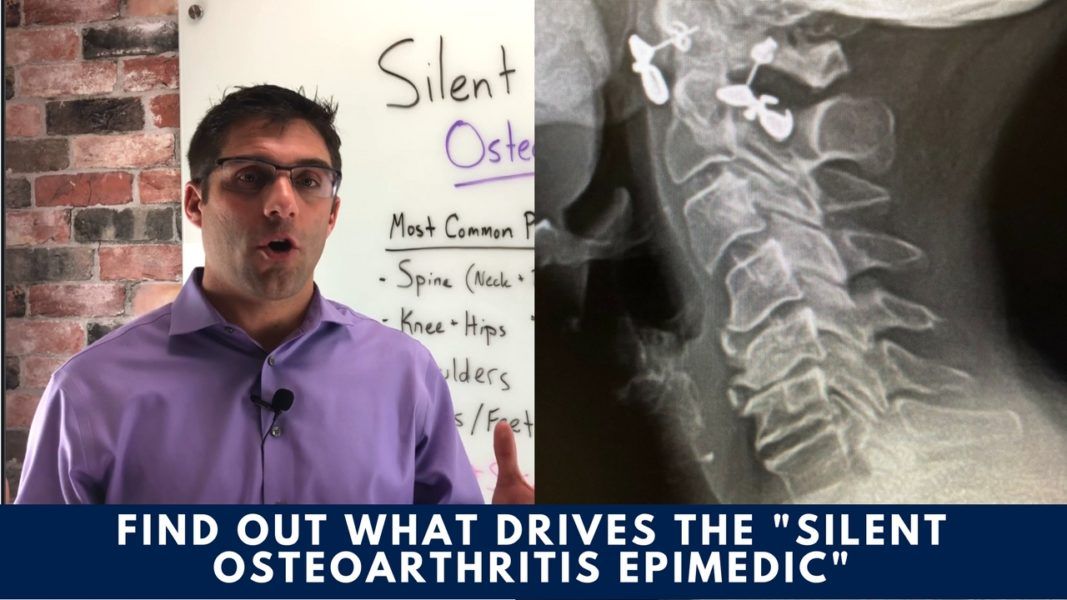 Silent Epidemic: Osteoarthritis