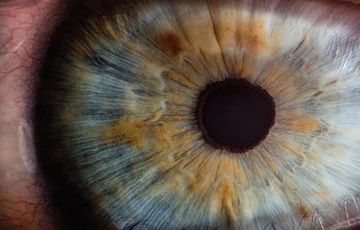 Why you may have glaucoma and not know