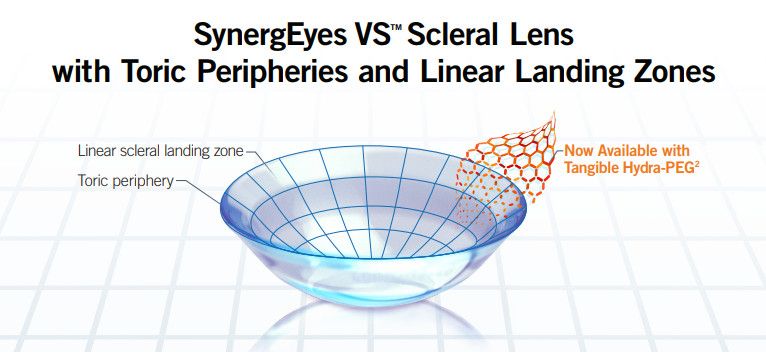 Scleral Lenses: A Vision-Saving Tool for Keratoconus