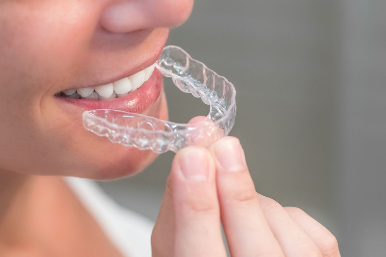 AN AFFORDABLE INVISALIGN DENTIST SHARES THE PROCEDURE, COST, AND BENEFITS OF THIS TREATMENT