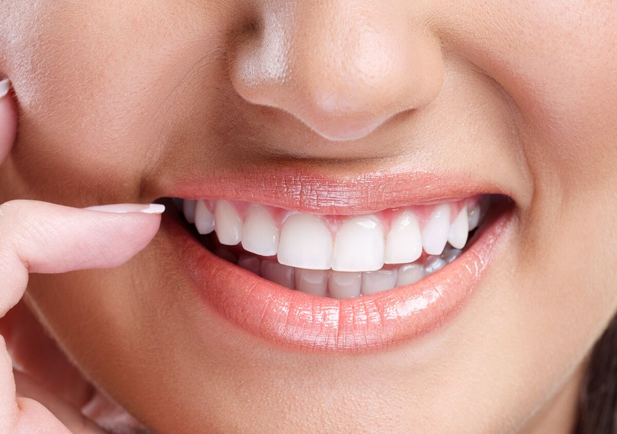 TEETH WHITENING AND SELF-ESTEEM