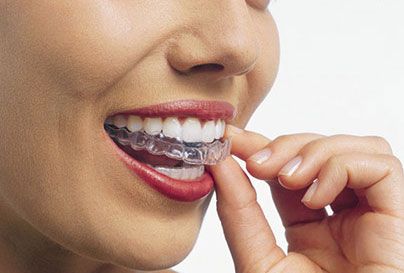 LAS VEGAS, NV AREA PATIENTS ENJOY INVISALIGN ON THEIR TEETH