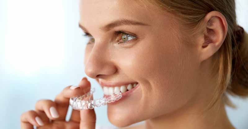 INVISALIGN TREATMENT VS. TRADITIONAL BRACES FOR PATIENTS IN LAS VEGAS, NV