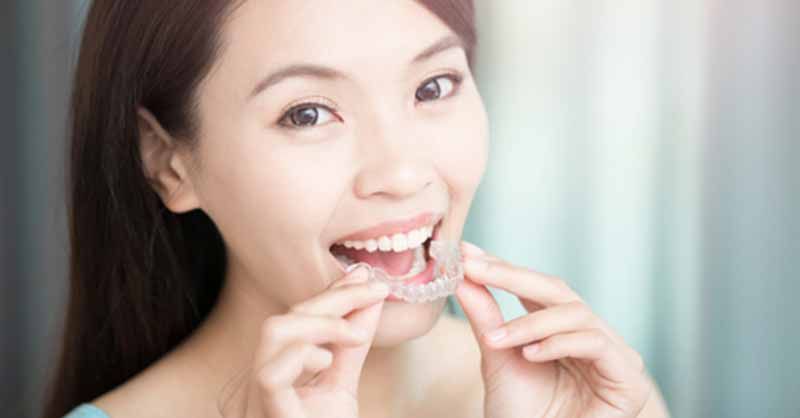INVISALIGN PROCESS OF TREATMENT GIVES LAS VEGAS RESIDENTS AN EFFICIENT OPTION