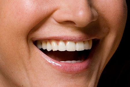TEETH WHITENING IN SOUTH LAS VEGAS: COMPARING COST TO VALUE